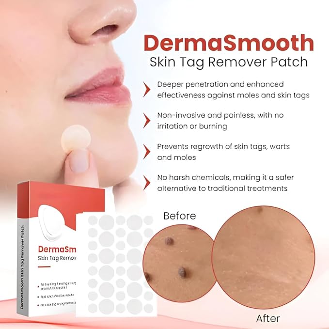 Derma Smooth Skin Tag Removal Patch - 72 Patches