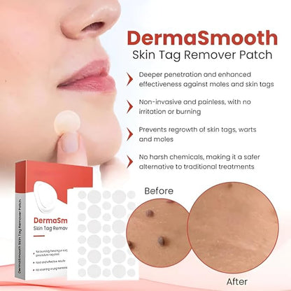Derma Smooth Skin Tag Removal Patch - 72 Patches